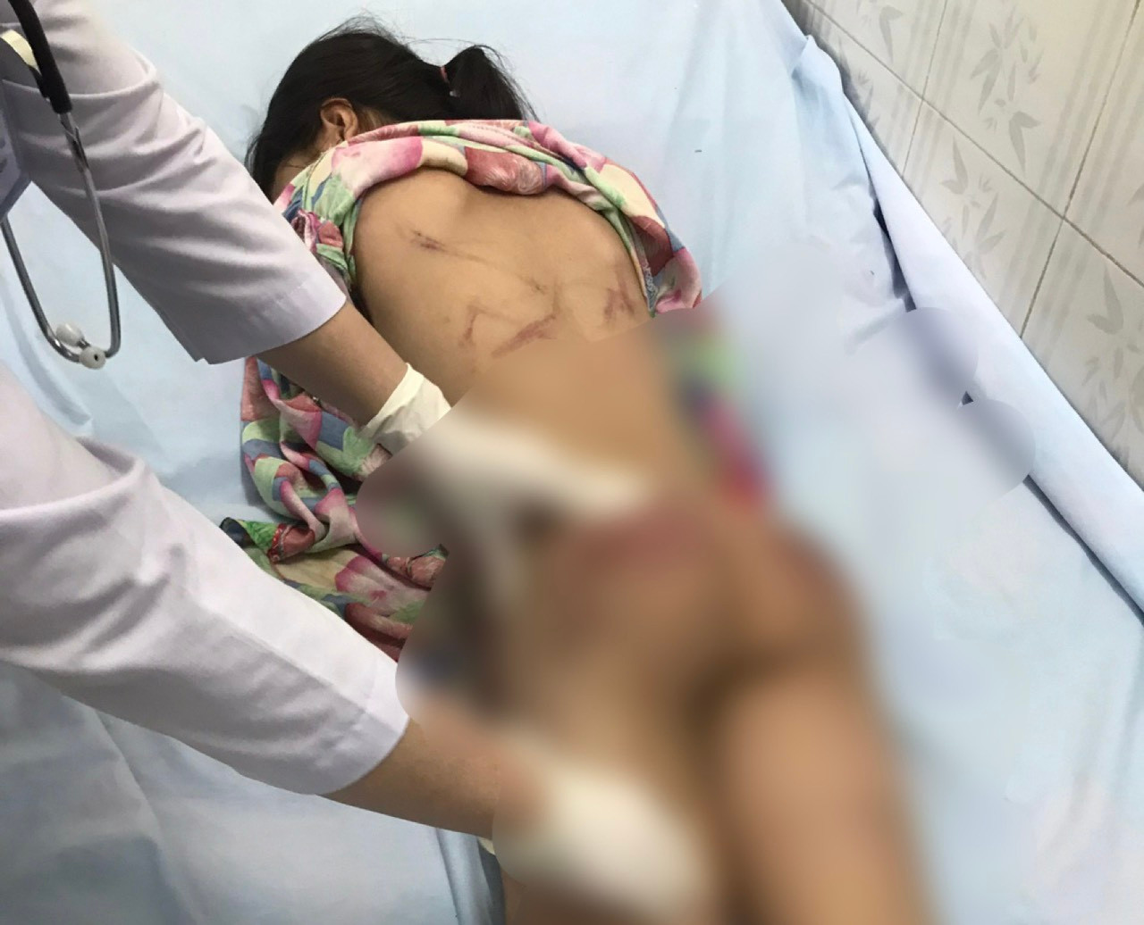 Bác sĩ kiểm tra các vết thương trên người bé H.T.L. Ảnh: CTV.