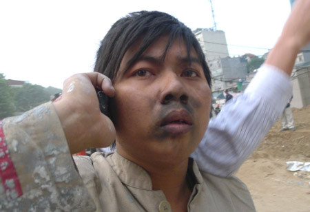 Một công nhân may mắn thoát ra khỏi đám cháy. Ảnh: Dân Trí. Một công nhân may mắn thoát ra khỏi đám cháy. Ảnh: Dân Trí