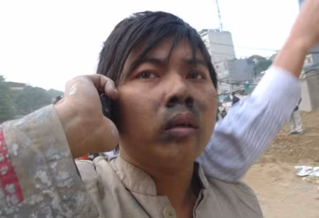 Một công nhân may mắn thoát ra khỏi đám cháy. Ảnh: Dân Trí