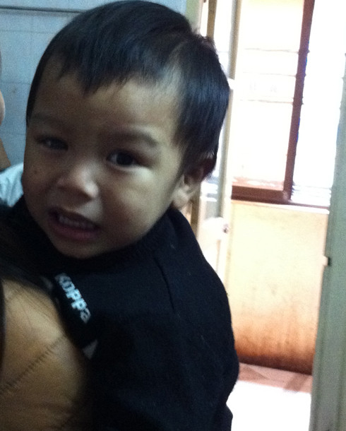 Cháu Lưu Kim Gia Bảo bị tổn thương mắt bên phải. Cháu Lưu Kim Gia Bảo bị tổn thương mắt bên phải