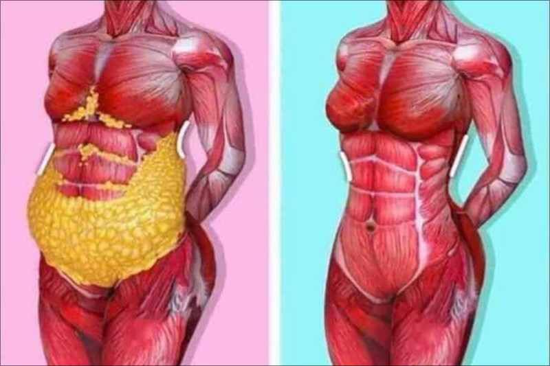 Mỡ tích tụ quanh bụng