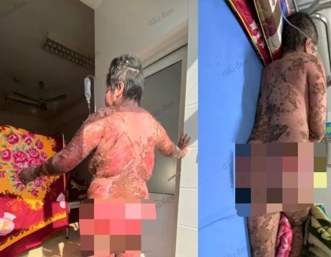 Tình trạng sức khoẻ của bệnh nhân đã ổn định