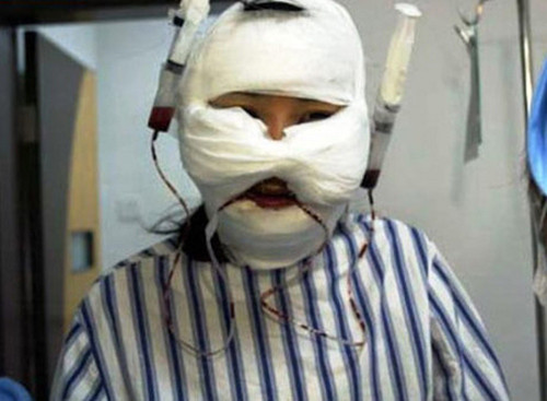 Phẫu thuật chuyển giới đi kèm nhiều loại hình phẫu thuật thẩm mỹ khác như phẫu thuật khuôn mặt, ngực…vì thế chi phí rất tốn kém cả về thời gian lẫn tiền bạc. Phẫu thuật chuyển giới đi kèm nhiều loại hình phẫu thuật thẩm mỹ khác như phẫu thuật khuôn mặt, ngực…vì thế chi phí rất tốn kém cả về thời gian lẫn tiền bạc