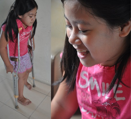 Cô bé lớp 5 có cột sống cong hình chữ... S ảnh 7