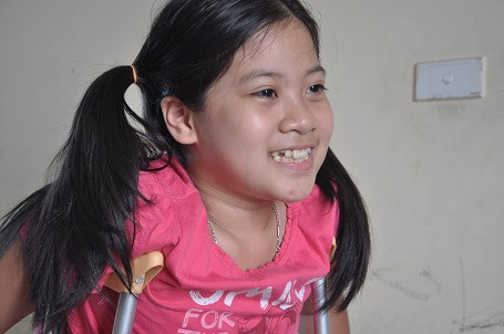 Cô bé lớp 5 có cột sống cong hình chữ... S ảnh 5