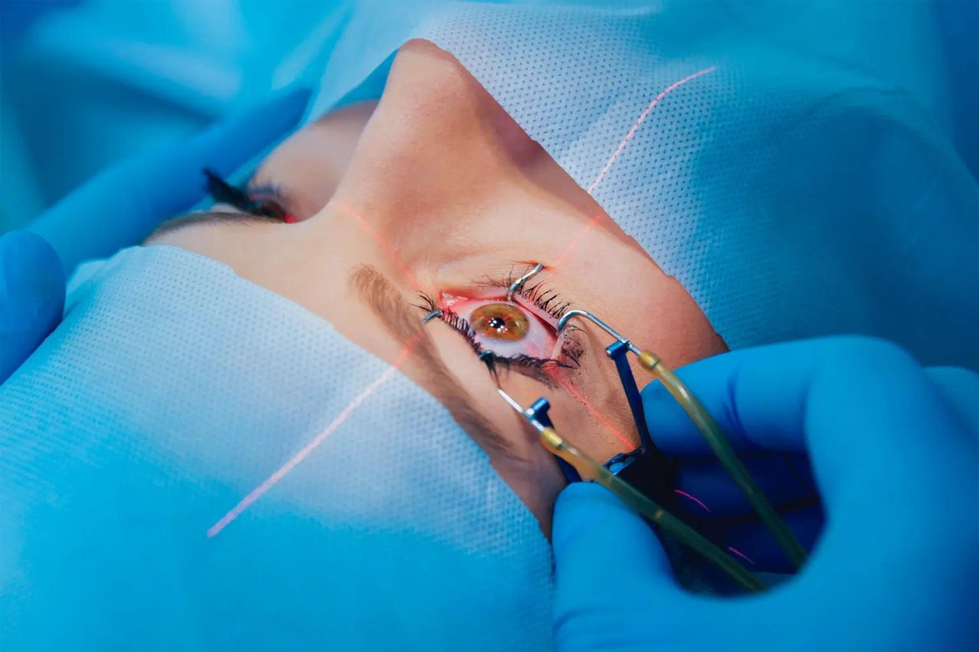 Phương pháp mổ mắt LASIK đã tồn tại 25 năm nay và rất phổ biến tại Mỹ. Phương pháp mổ mắt LASIK đã tồn tại 25 năm nay và rất phổ biến tại Mỹ.