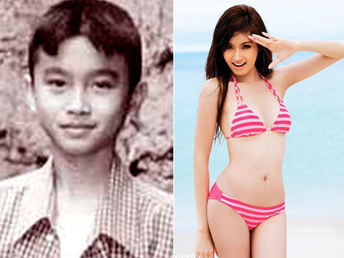 Poy trước và sau khi phẫu thuật chuyển giới