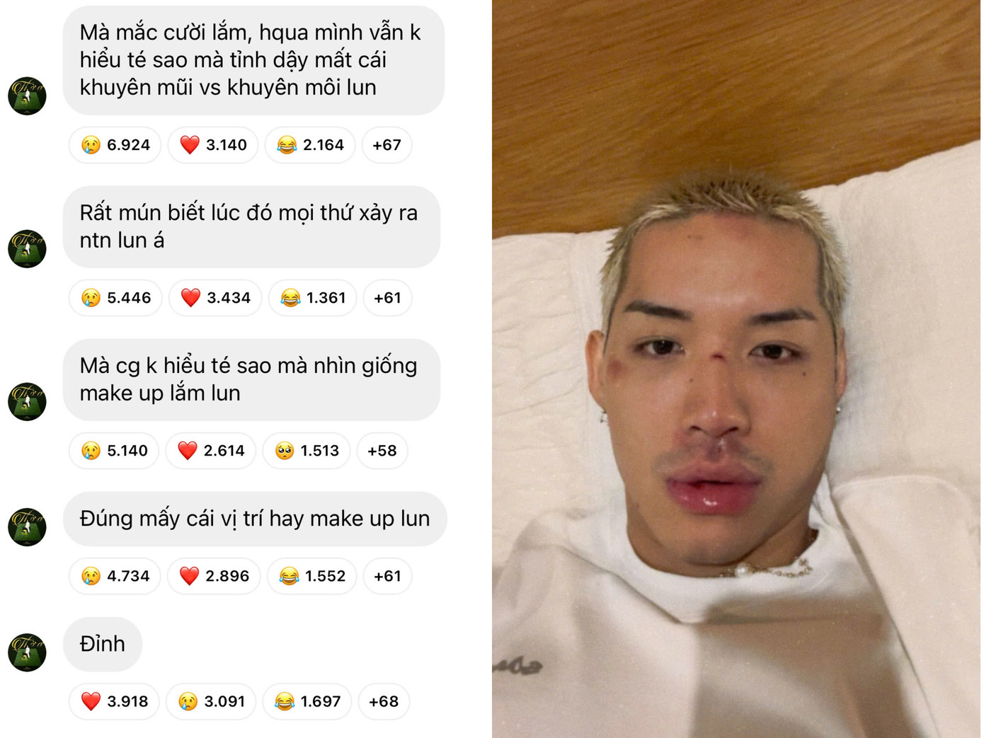 Nam rapper WEAN LE khiến fan lo lắng khi chia sẻ bản thân vừa bị ngã bất tỉnh trên đường. Nam rapper WEAN LE khiến fan lo lắng khi chia sẻ bản thân vừa bị ngã bất tỉnh trên đường.