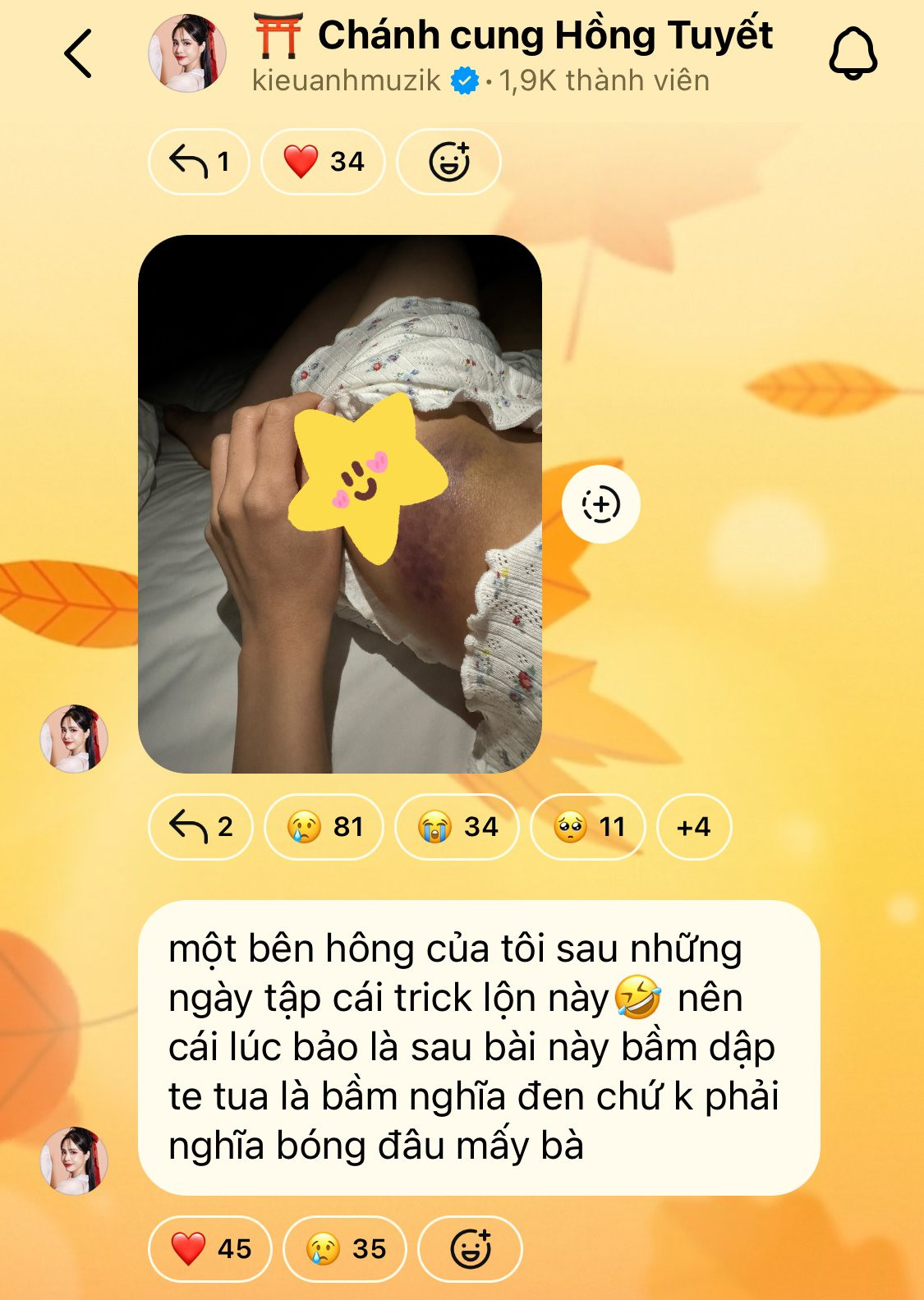 Kiều Anh bị thương nặng sau cú nhào lộn thất bại.