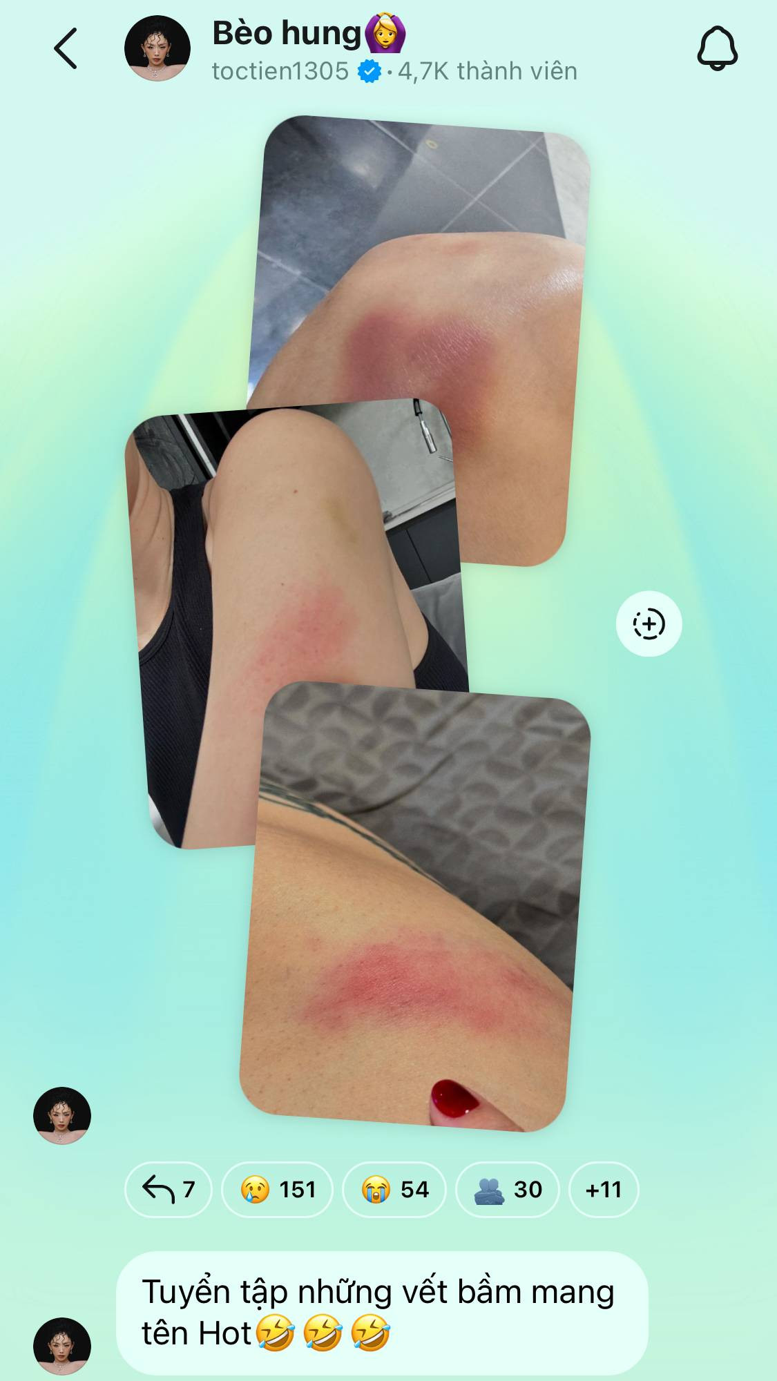 Tuyển tập vết bầm của Tóc Tiên khi luyện tập tiết mục HOT.