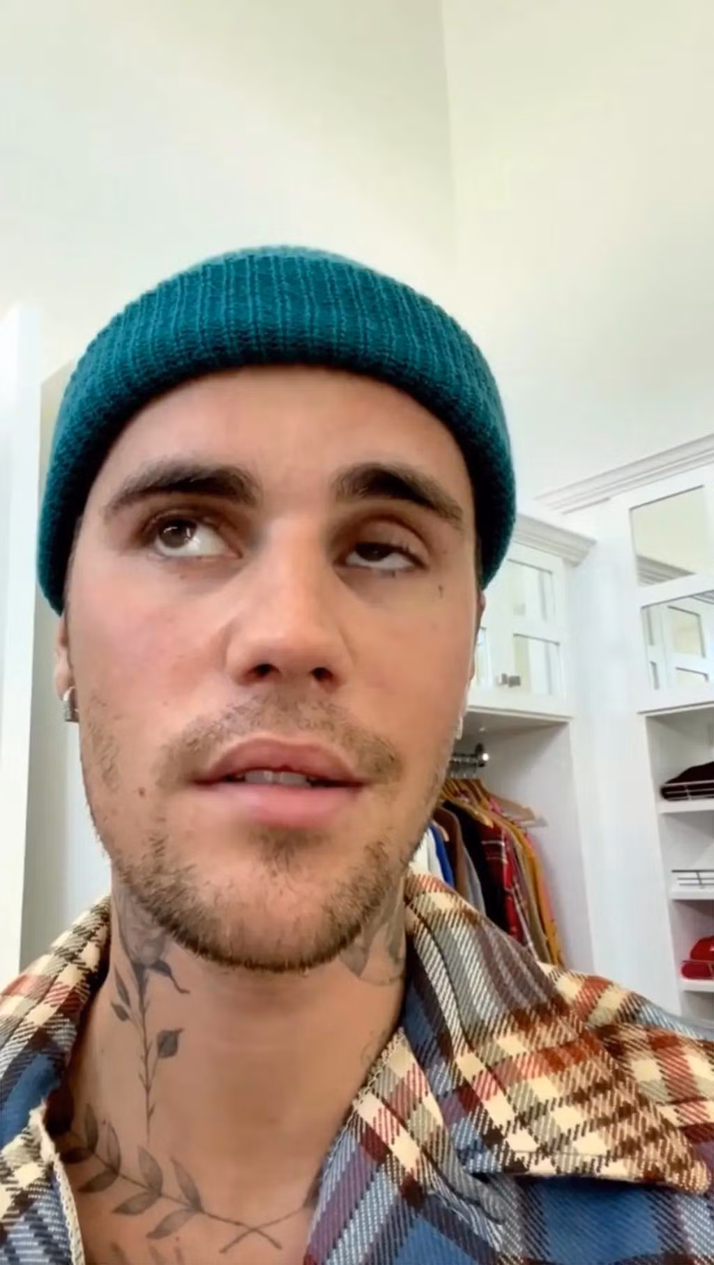 Justin từng hoãn chuyến lưu diễn vì liệt nửa mặt do hội chứng Ramsay Hunt.