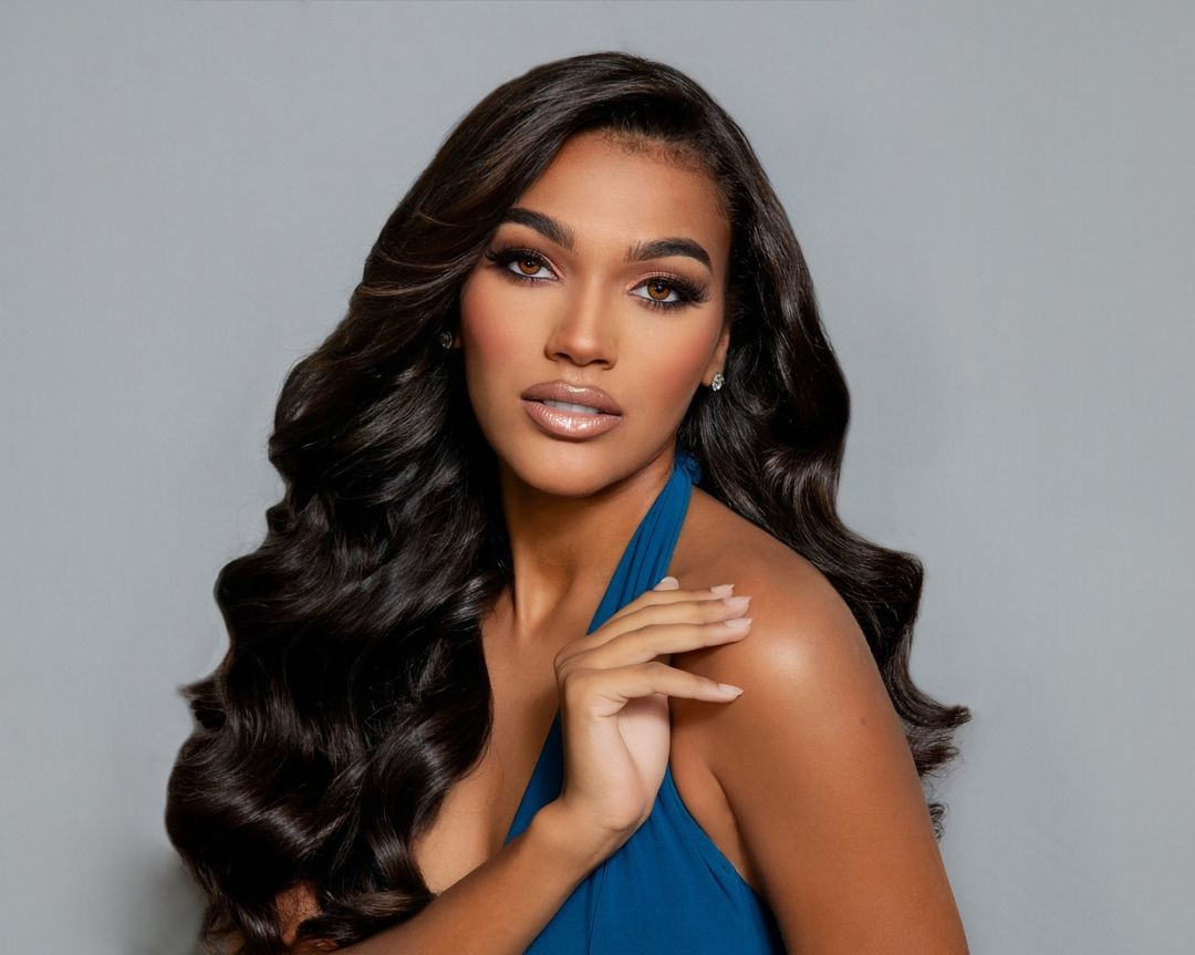 Kimberly de Boer năm nay 18 tuổi, là sinh viên, người mẫu ở quê nhà.