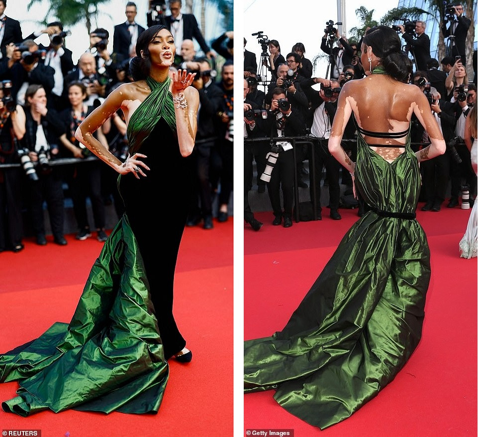 Người mẫu bạch biến Winnie Harlow đằm thắm và cổ điển hơn trong chiếc đầm đen - xanh đậm hở lưng. Ảnh: Reuters/Getty Images.