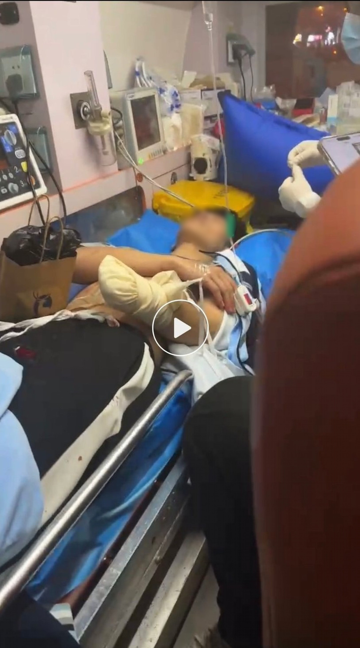 Shi được đưa vào bệnh viện sau đó để băng bó cánh tay bị thương nghiêm trọng. Shi được đưa vào bệnh viện sau đó để băng bó cánh tay bị thương nghiêm trọng.