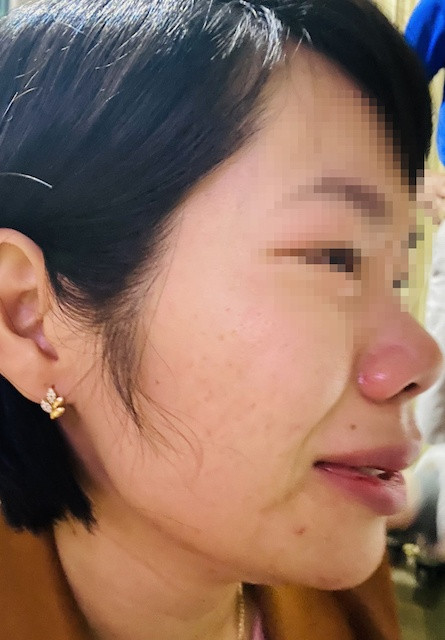 Theo chồng cô giáo Q., cô bị đánh vào mặt, đá vào người và túm tóc dúi xuống nền nhà. Ảnh: NVCC. Theo chồng cô giáo Q., cô bị đánh vào mặt, đá vào người và túm tóc dúi xuống nền nhà. Ảnh: NVCC.