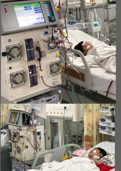 Bị ong vò vẽ tấn công, 2 người chết, 3 người nguy kịch ảnh 1