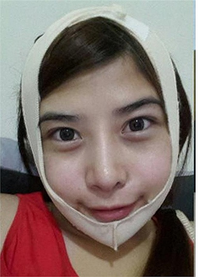 Khuôn mặt của Dora đã trở nên bình thường và có phần sắc sảo hơn sau 2 tuần lễ