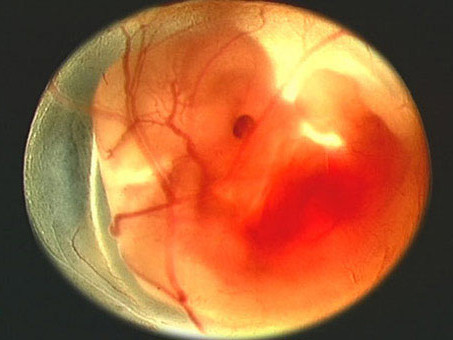 Nhau thai rất quan trọng với thai nhi Ảnh: Tư liệu