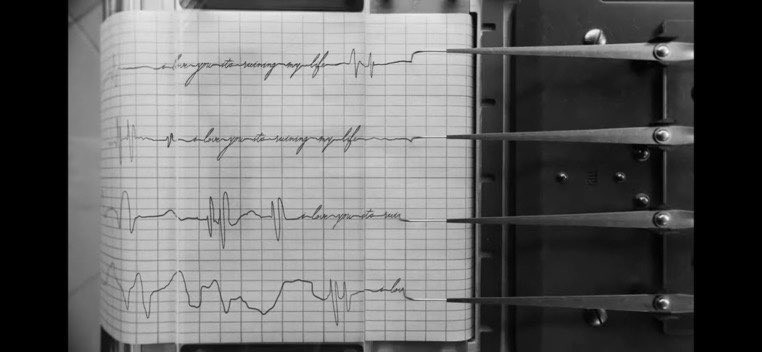 Hình ảnh điện tim với dòng chữ "I love you, it's ruining my life". Hình ảnh điện tim với dòng chữ "I love you, it's ruining my life".
