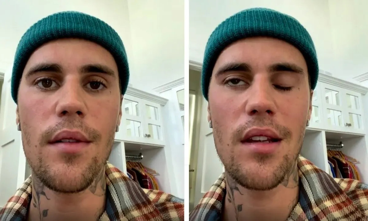 Justin Bieber đăng đoạn video bị liệt nửa bên mặt khiến người hâm mộ lo lắng.