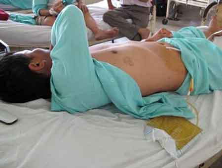 Một người đàn ông bị cắt của quý. Ảnh chỉ mang tính minh họa. Một người đàn ông bị cắt của quý (ảnh minh họa)