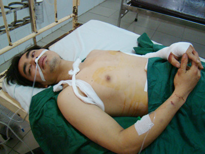 Anh Trần Thanh Chương đang được cấp cứu tại bệnh viện