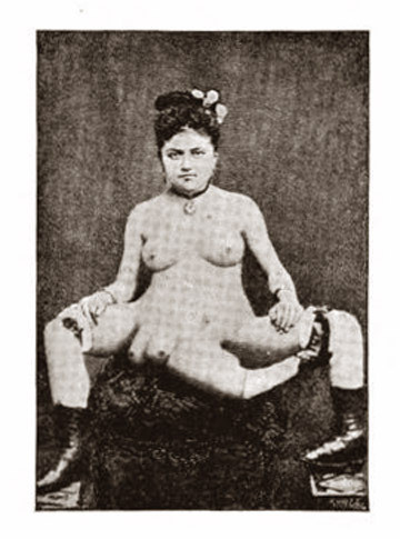 Blanche Dumas khi trưởng thành qua ảnh chụp và tranh vẽ.