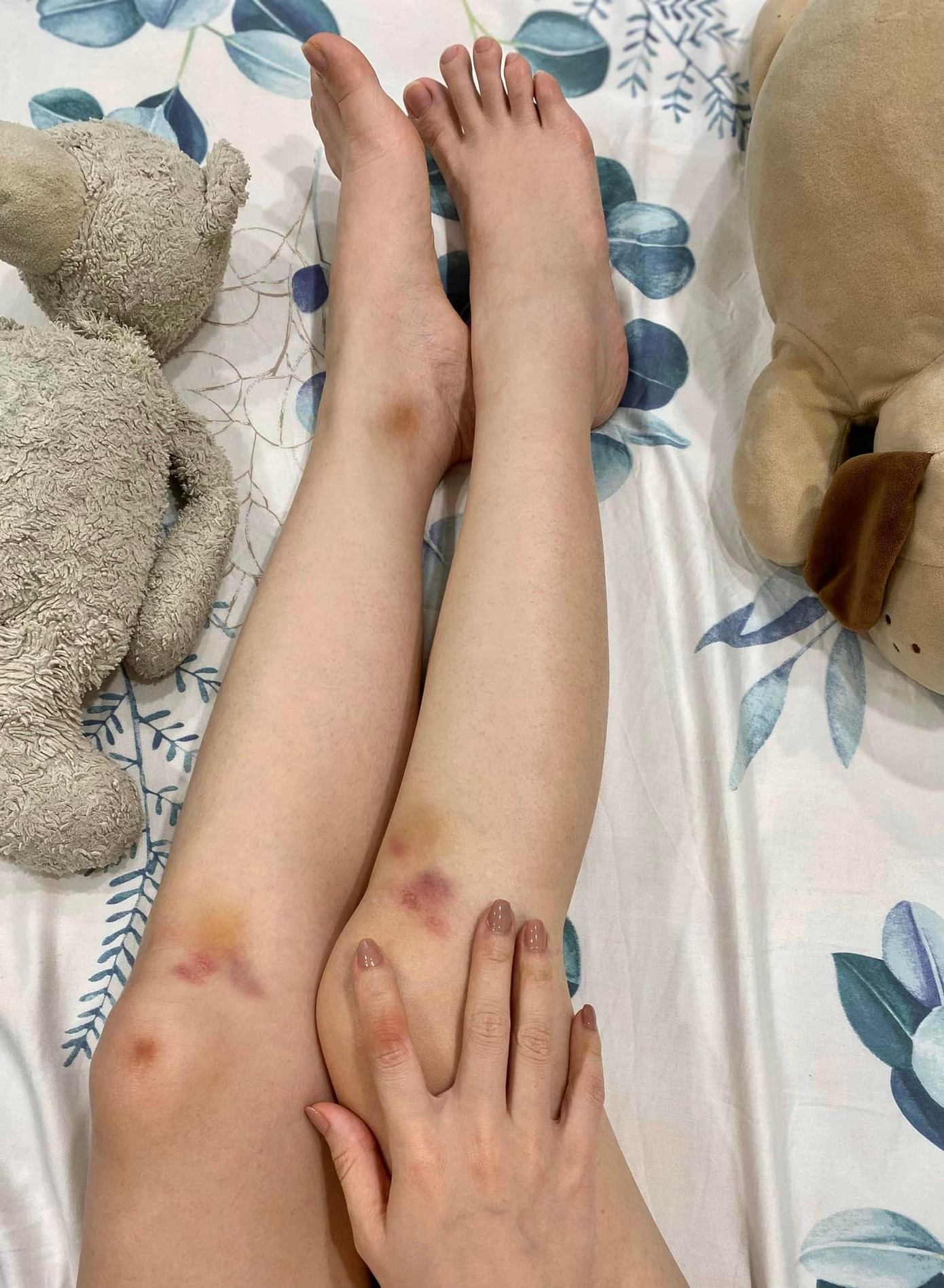 Đan Lê bầm dập, thương tích đầy người vì những cảnh quay bị bạo hành. Ảnh: FBNV