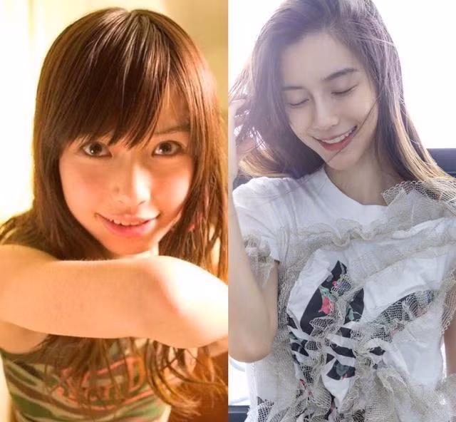 Angelababy trước và sau khi niềng răng. Angelababy trước và sau khi niềng răng.