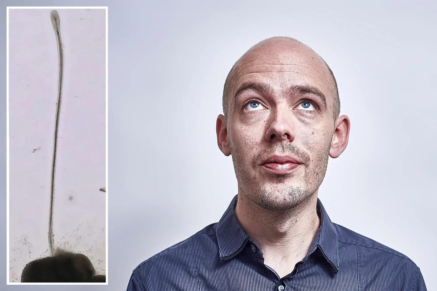 Trong tương lai sẽ có thuốc hoặc công nghệ tái tạo tóc cho con người. Trong tương lai sẽ có thuốc hoặc công nghệ tái tạo tóc cho con người.