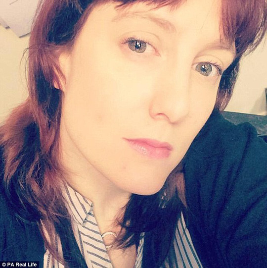 Người phụ nữ mù mắt sau 20 phút đeo kính áp tròng xuống hồ bơi ảnh 2