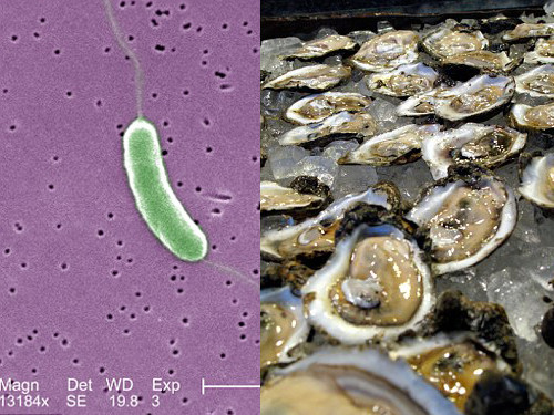 CẢNH BÁO: Vi khuẩn ăn thịt người khi đi tắm biển ảnh 2