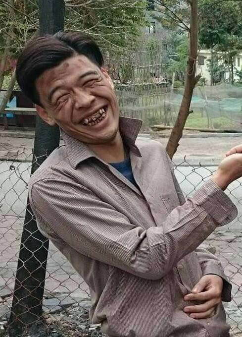 Diễn viên Trung Ruồi: ‘Tôi bị chê xấu nhiều đến mức thành quen' ảnh 1