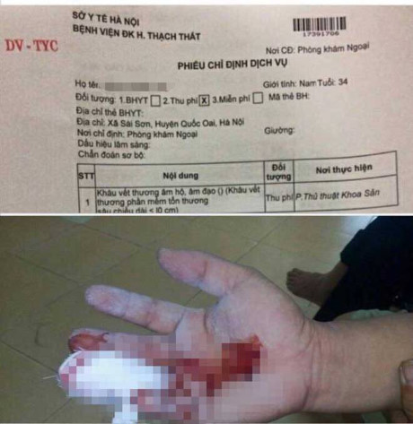 Ngành y tế nói gì vụ "nam bệnh nhân đứt tay có chỉ định khâu âm đạo"? ảnh 1