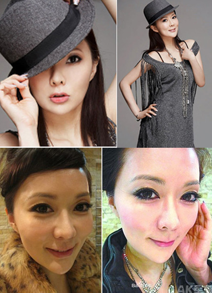 Trần Lợi Mẫn, người đẹp lọt vào vòng chung kết cuộc thi Miss Hong Kong 1995 (nay là MC đài TVB) từng làm hàng chục cuộc phẫu thuật thẩm mỹ. Cô thừa nhận 