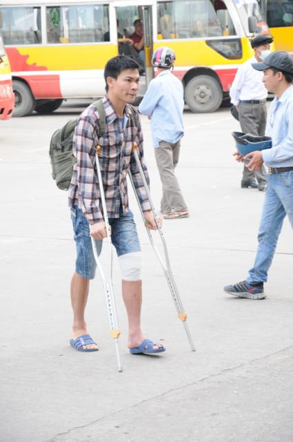 Tranh thủ về quê nghỉ dưỡng. Một thanh niên bị gãy chân cũng tranh thủ về quê nghỉ dưỡng
