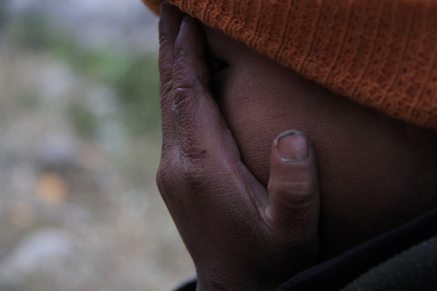 Da tay, da mặt em bé ở xã Sà Phìn nứt nẻ vì giá lạnh. Ảnh: Trường Phong. 