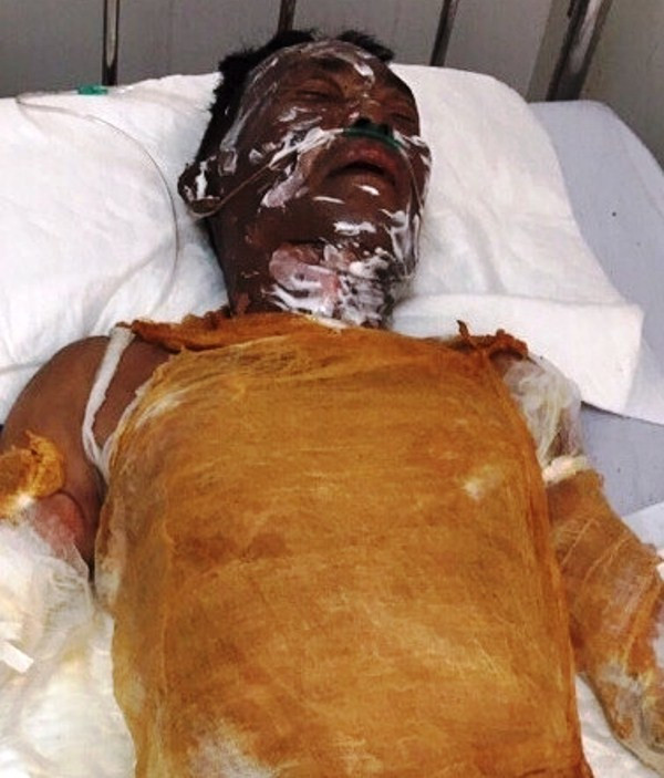 Bị tẩm xăng đốt, người đàn ông biến thành ngọn đuốc sống ảnh 1