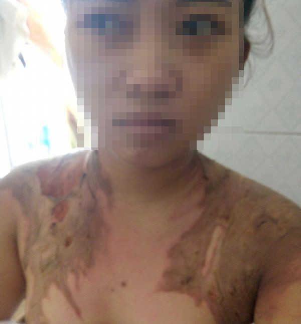 Bắt giam người đàn ông dội nước sôi lên cơ thể vợ ảnh 1