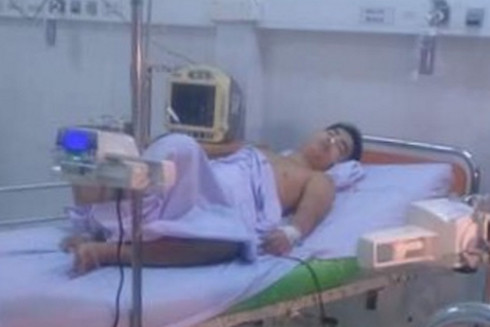 Dùng súng bút bắn thủng bụng bạn nhậu ảnh 1