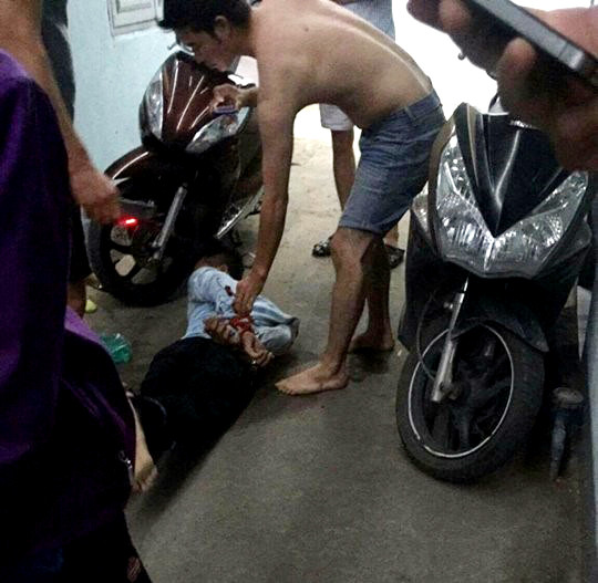 Bị phát hiện, tên trộm dùng roi điện tấn công chủ nhà ảnh 1