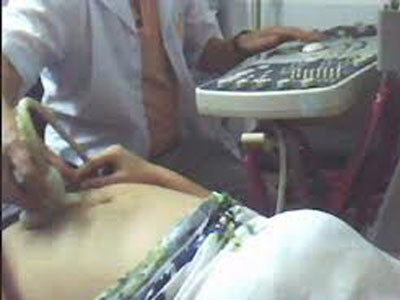 Muốn siêu âm giới tính thai nhi không khó