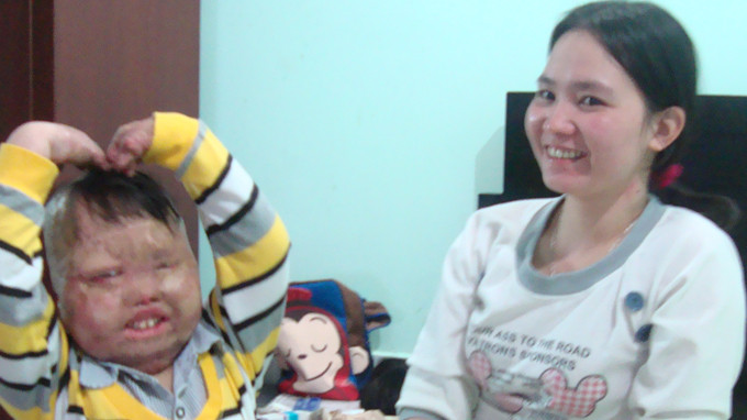 Cậu bé dũng cảm Vũ Quốc Linh và mẹ - Ảnh: M.LĂNG. Cậu bé dũng cảm Vũ Quốc Linh và mẹ - Ảnh: M.LĂNG