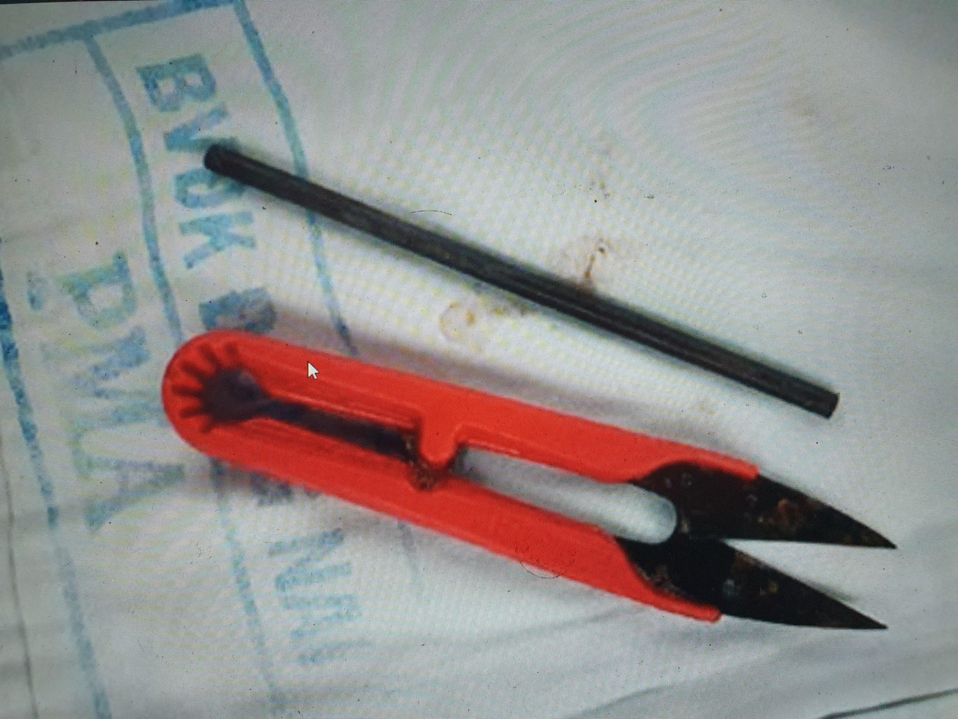 Dị vật lấy ra từ dạ dày của bệnh nhân Dị vật lấy ra từ dạ dày của bệnh nhân