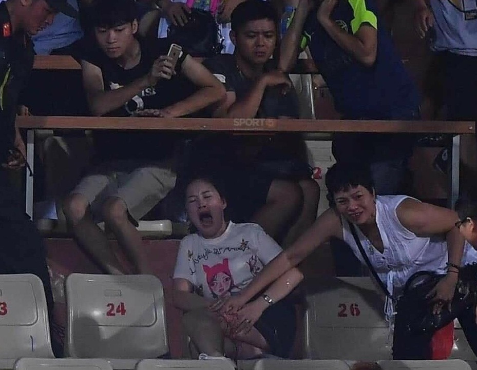 TP Hà Nội chỉ đạo làm rõ vụ đốt pháo sáng khiến 2 người bị thương ảnh 1