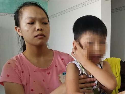 Quảng Nam: Giáo viên mầm non bị tố đánh trẻ chấn động não ảnh 1