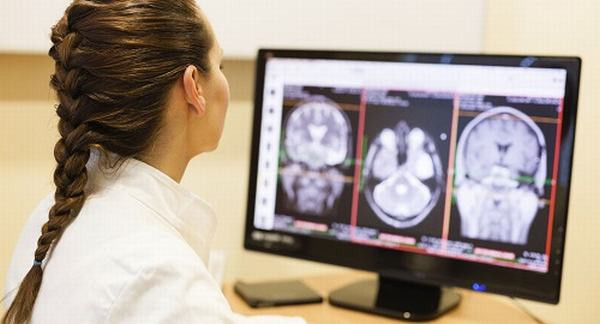 Những cơn đau đầu cảnh báo căn bệnh 'giết người trong chớp mắt' ảnh 2