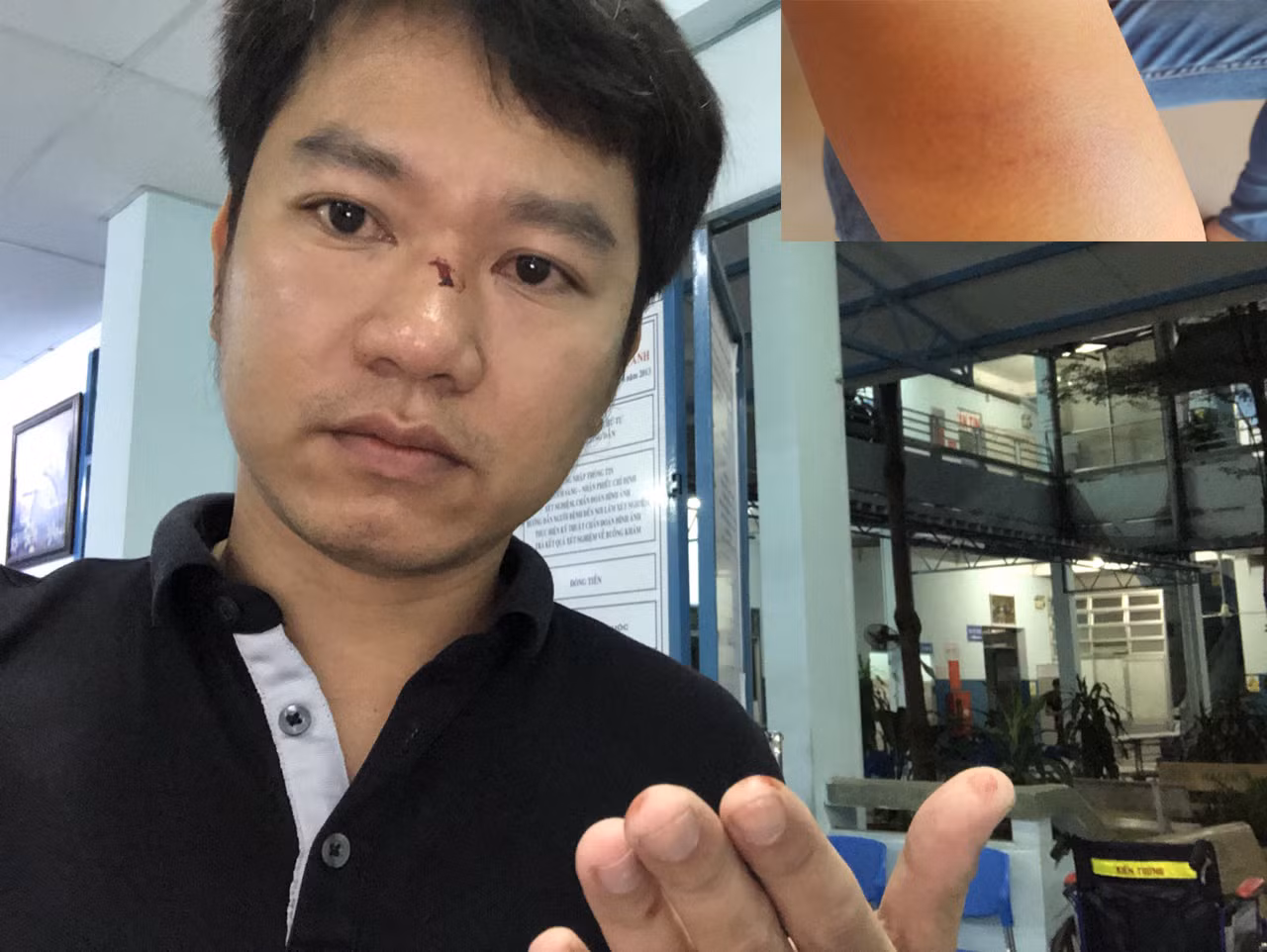 Người dân 'tố' bị người lạ hành hung khi làm việc với CSGT Hàng Xanh ảnh 2