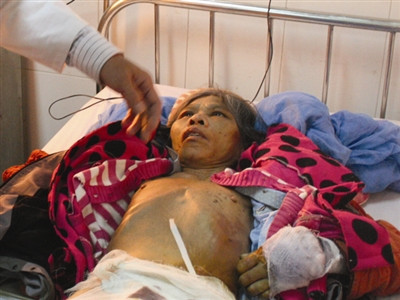 BS đang kiểm tra các vết bỏng trên người bà Phương