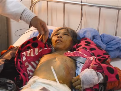 BS đang kiểm tra các vết bỏng trên người bà Phương